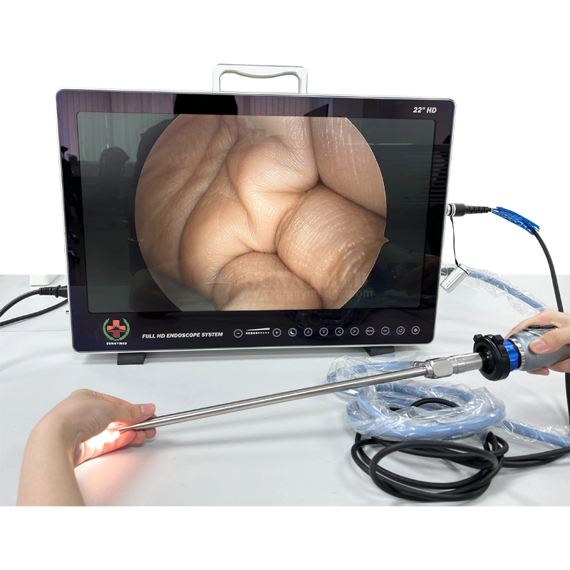 Sy-PS050 Medical Ent/Urology/Arthroscopy/Laparoscopy/Hysteroscopy/Spine Endoscope Integrated 4 in 1 Portable HD Endoscope Camera System