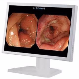 Ysvme2800 Medical Device Bronchoscope Laryngoscope Gastroscope Colonoscope Video Endoscope System