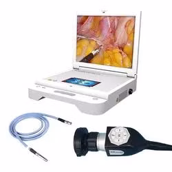 Portable Endoscope Camera System for Ent Endoscope Disease Diagnosis